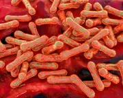 Diphtheria Outbreak Exposes Health Gap in Remote Indigenous Communities