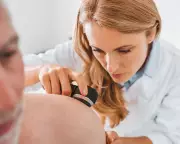 Melanoma Skin Cancer Cases in UK Hit Record High, Charity Warns