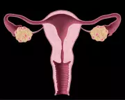 NHS Urged to Update Website After PCOS Renamed to PMOS