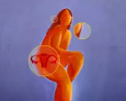 PCOS Renamed to PMOS: New Name Reflects Complex Metabolic Disorder