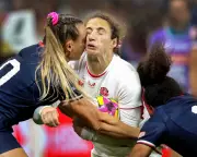 Study to Investigate Repeated Head Blows in Women's Rugby