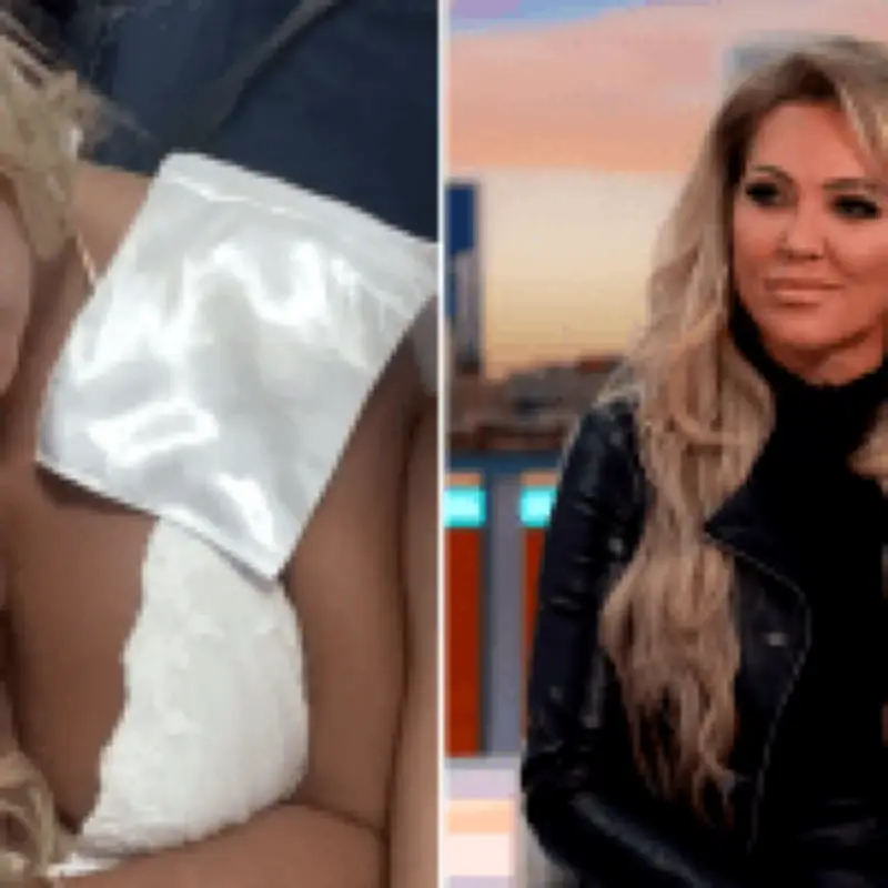 Big Brother star Aisleyne Horgan-Wallace 'scarred for life' after XL Bully attack