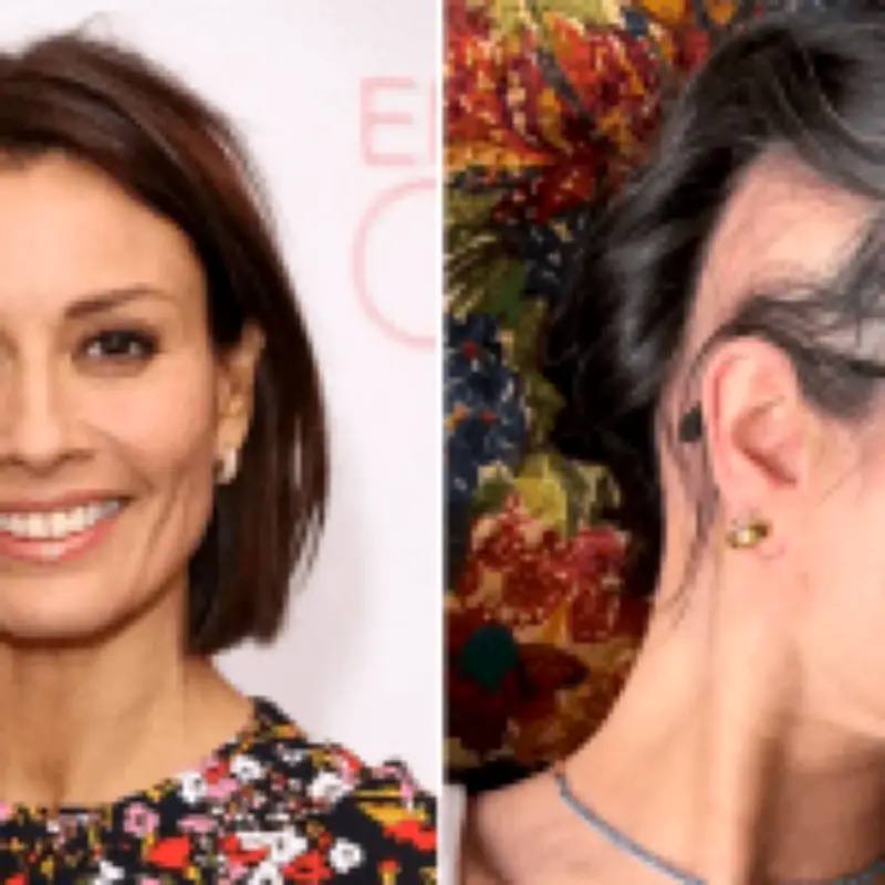 Melanie Sykes reveals extreme alopecia after going 'two-thirds bald'
