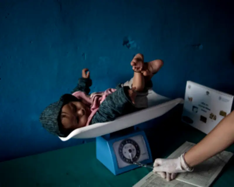 Nepal child malnutrition reaches alarming levels after USAID cuts