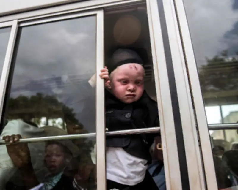 Nigerian with albinism deported under Trump asylum crackdown despite siblings' success