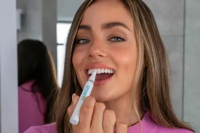 SmilePro Teeth Whitening Kit: A Comprehensive Review for Londoners