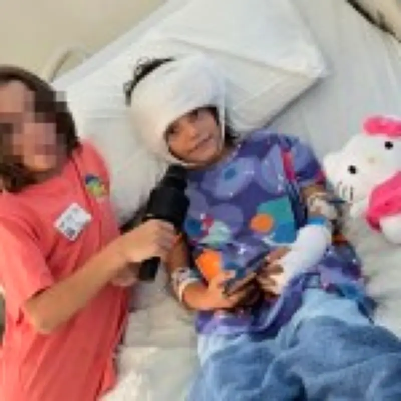 7-year-old girl's scalp ripped off by pack of stray dogs in California attack