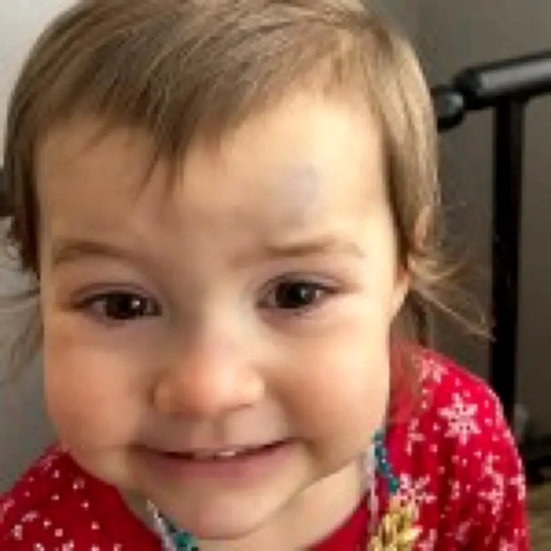 Toddler's 'terrible twos' meltdowns were actually rare blood cancer